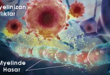 Multiple Skleroz (MS)