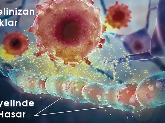 Multiple Skleroz (MS)