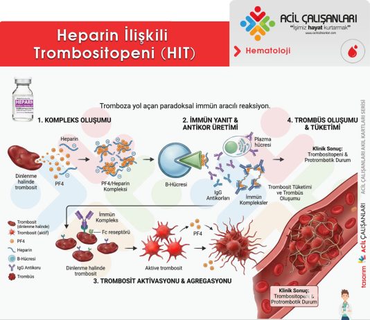 Heparin İlişkili Trombositopeni (HIT)