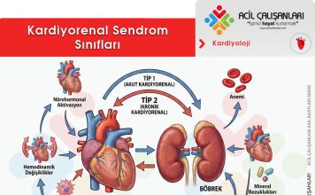 Kardiyorenal Sendrom