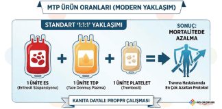 Masif Transfüzyon Protokolü (MTP)