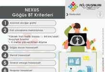 NEXUS Göğüs BT Kriterleri (Künt Toraks Travması)