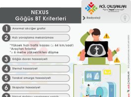 NEXUS Göğüs BT Kriterleri (Künt Toraks Travması)