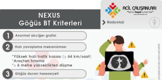 NEXUS Göğüs BT Kriterleri (Künt Toraks Travması)