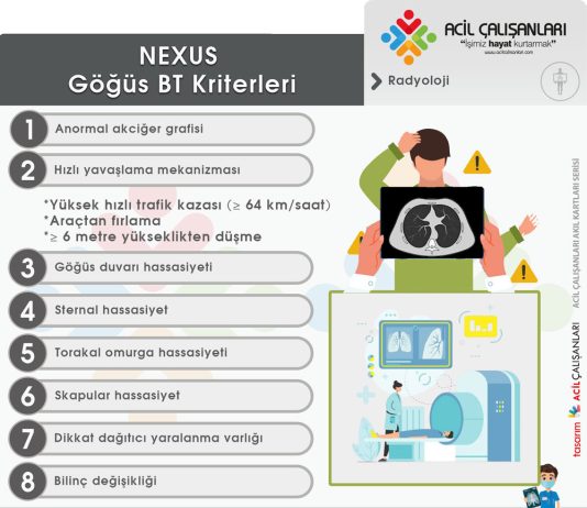 NEXUS Göğüs BT Kriterleri (Künt Toraks Travması)