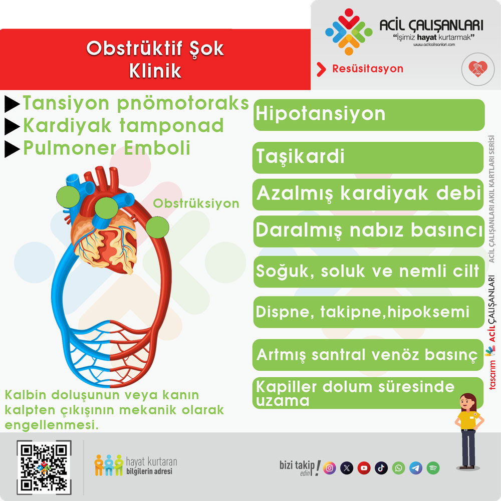 Obstrüktif Şok Klinik Bulgular