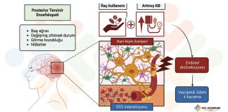 Posterior Reversibl Ensefelopati Sendromu (PRES)