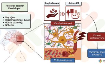 Posterior Reversibl Ensefelopati Sendromu (PRES)