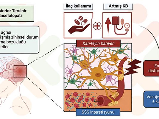 Posterior Reversibl Ensefelopati Sendromu (PRES)