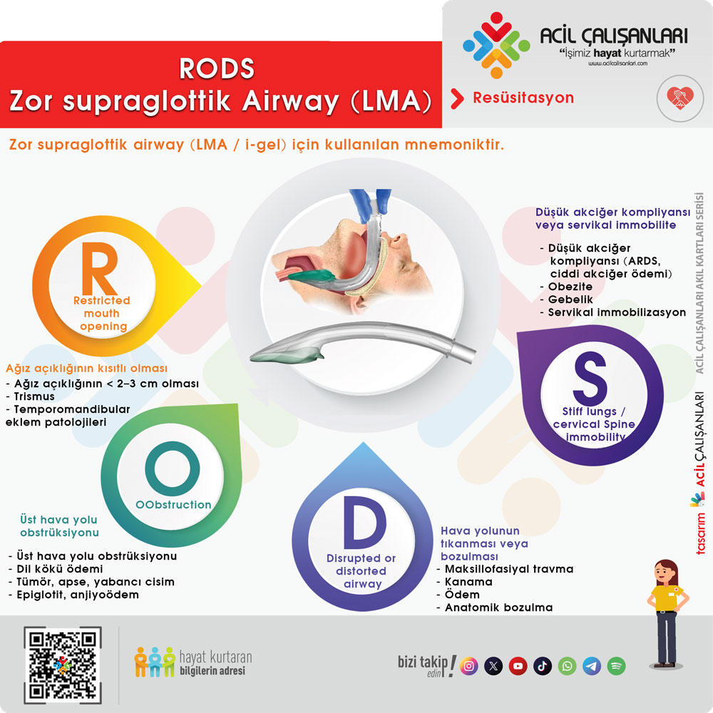RODS Zor Supraglottik Airway