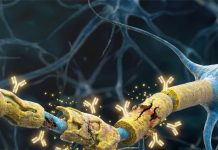 Demiyelinizan Hastalıklar