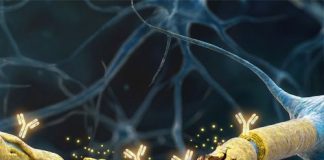 Demiyelinizan Hastalıklar