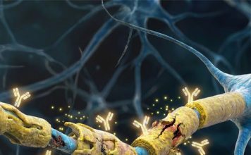 Demiyelinizan Hastalıklar