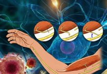 Periferik Sinir Yaralanmaları