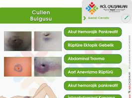 Cullen (Sign) Bulgusu