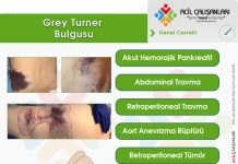 Grey Turner (Sign) Bulgusu