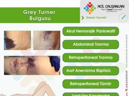 Grey Turner (Sign) Bulgusu