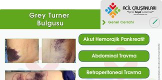 Grey Turner (Sign) Bulgusu