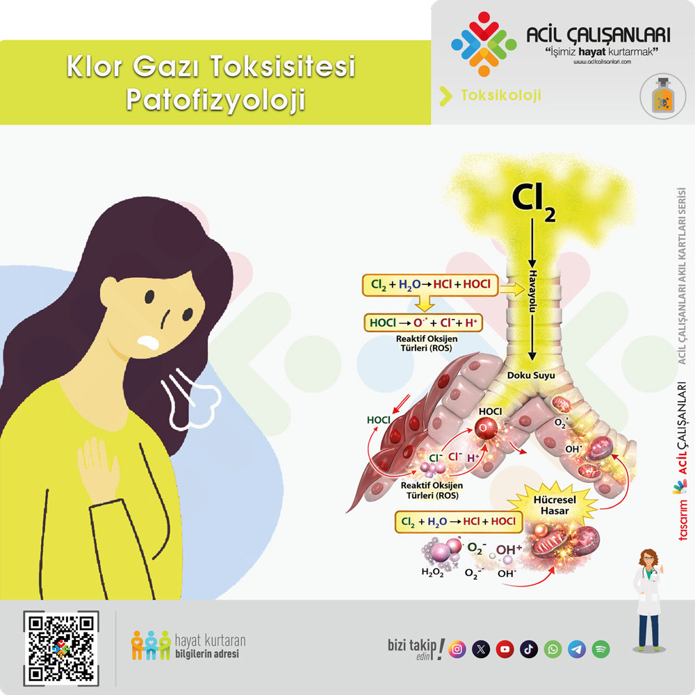 Klor Gazı Toksisitesi Patofizyoloji