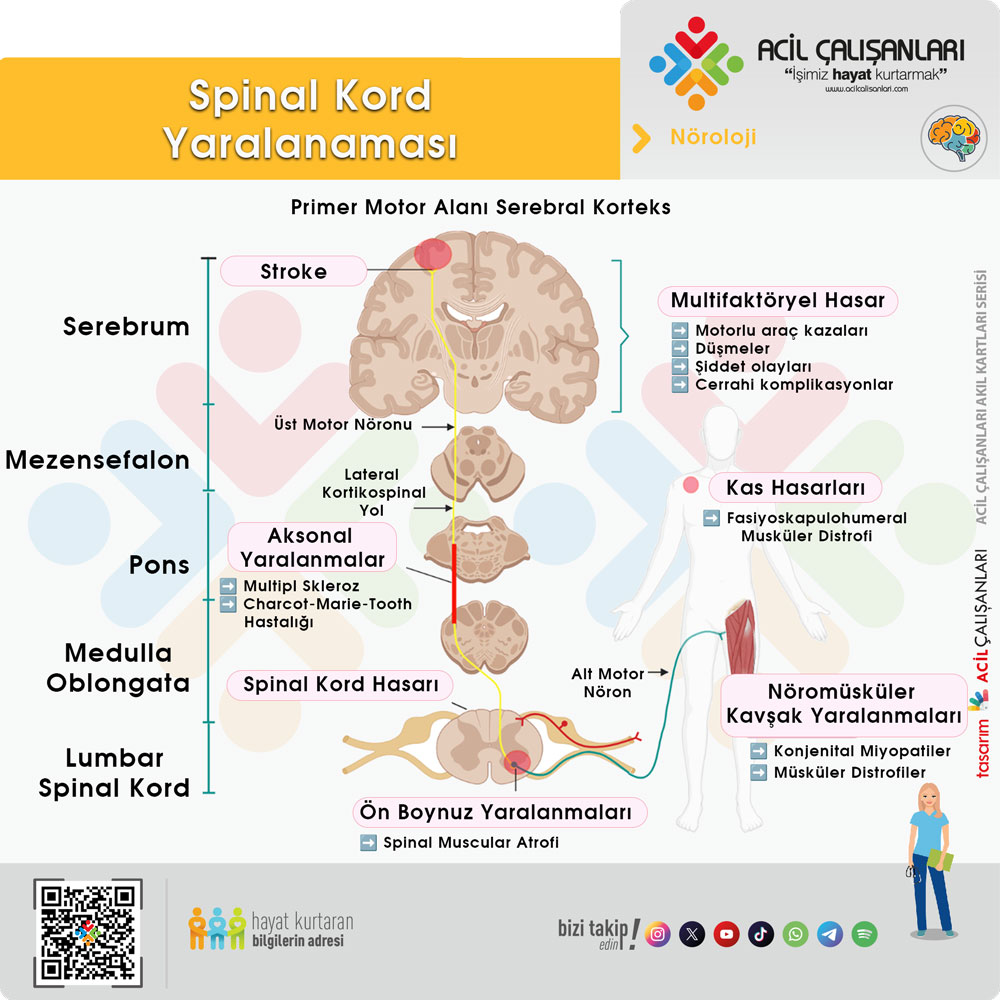 Spinal Kord Yaralanması