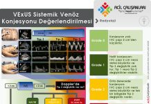 Venöz Yüklenme Ultrason Skoru (VExUS)