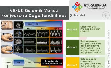 Venöz Yüklenme Ultrason Skoru (VExUS)