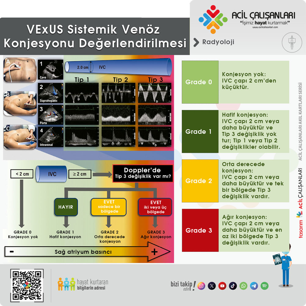 VExUS Değerlendirmesi 2
