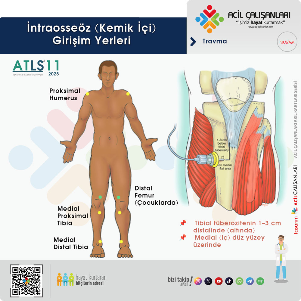 İntraosseöz Girişim Yerleri