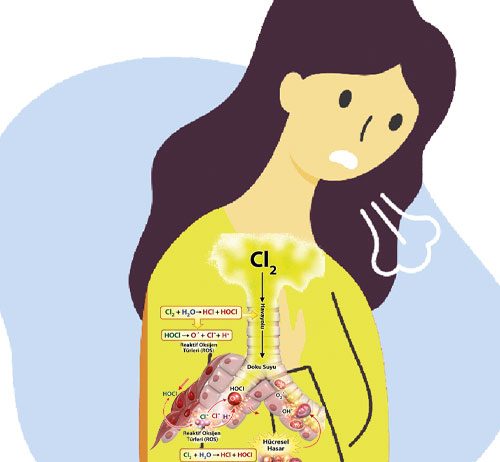 Klor Gazı Toksisitesi