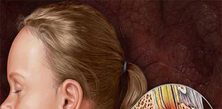 Spinal Kord Yaralanmaları