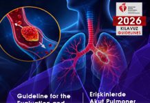 Akut Pulmoner Emboli Kılavuzu 2026