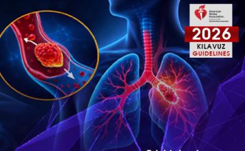 2026 Akut Pulmoner Emboli Kılavuzuna Göre Akut Yönetim