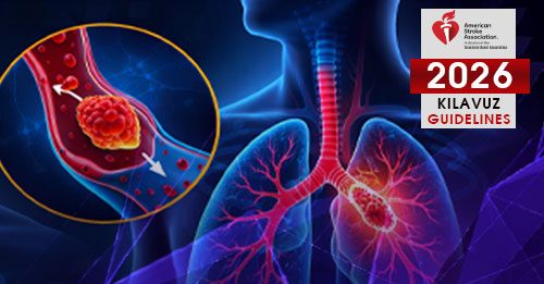 Akut Pulmoner Emboli Kılavuzu 2026