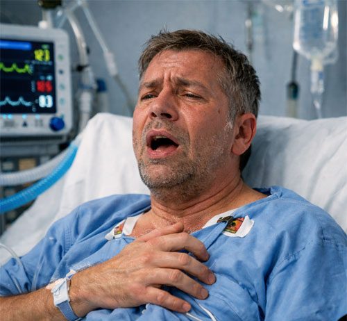 ARDS (Akut Solunum Sıkıntısı Sendromu): Acil Serviste Tanı, İlk Yaklaşım ve Ventilasyon