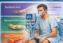 Akut Nöromüsküler Zayıflık