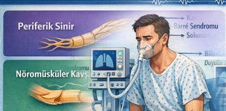 Akut Nöromüsküler Zayıflık