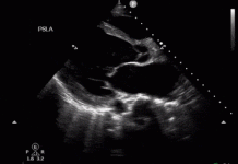 Kritik Hastalarınızın USG ile Değerlendirilmesi (POCUS)