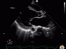 Kritik Hastalarınızın USG ile Değerlendirilmesi (POCUS)