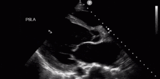 Kritik Hastalarınızın USG ile Değerlendirilmesi (POCUS)