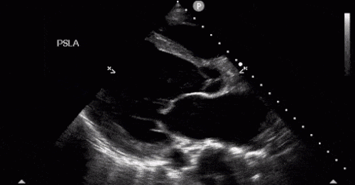 Kritik Hastalarınızın USG ile Değerlendirilmesi (POCUS)