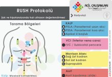 RUSH Protokolü Kritik Hasta Değerlendirme