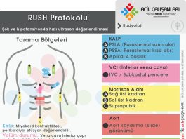 RUSH Protokolü Kritik Hasta Değerlendirme