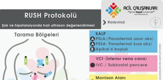 RUSH Protokolü Kritik Hasta Değerlendirme