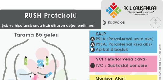 RUSH Protokolü Kritik Hasta Değerlendirme