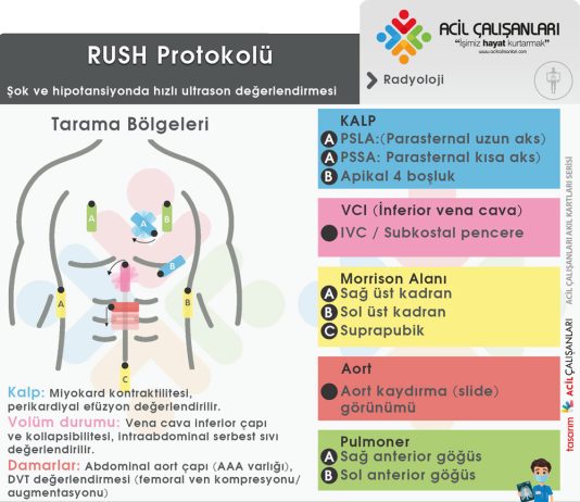 RUSH Protokolü Kritik Hasta Değerlendirme