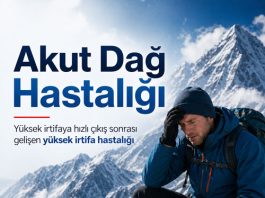 Akut Dağ Hastalığı (AMS)