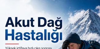 Akut Dağ Hastalığı (AMS)