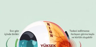 Glokom Acil Yaklaşım