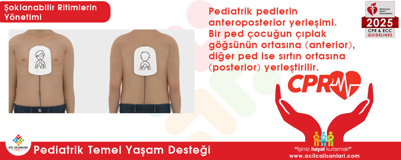 Kaşık ve ped kullanımı