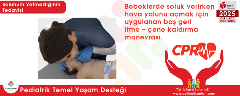 Bebeklerde havayolu açma manevrası